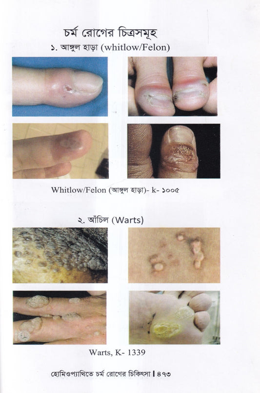 হোমিওপ্যাথিতে চর্মরোগের চিকিৎসা