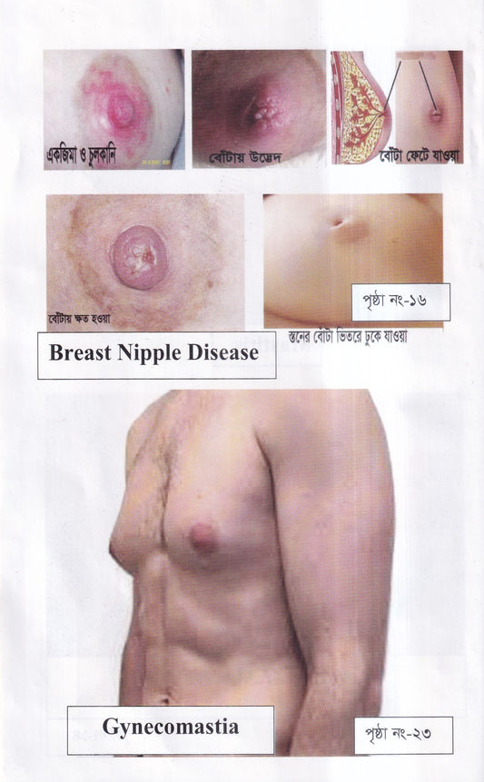 দ্যা হ্যান্ড বুক অফ গাইনী ডিজিজ (The Hand Book of Gynae Disease)