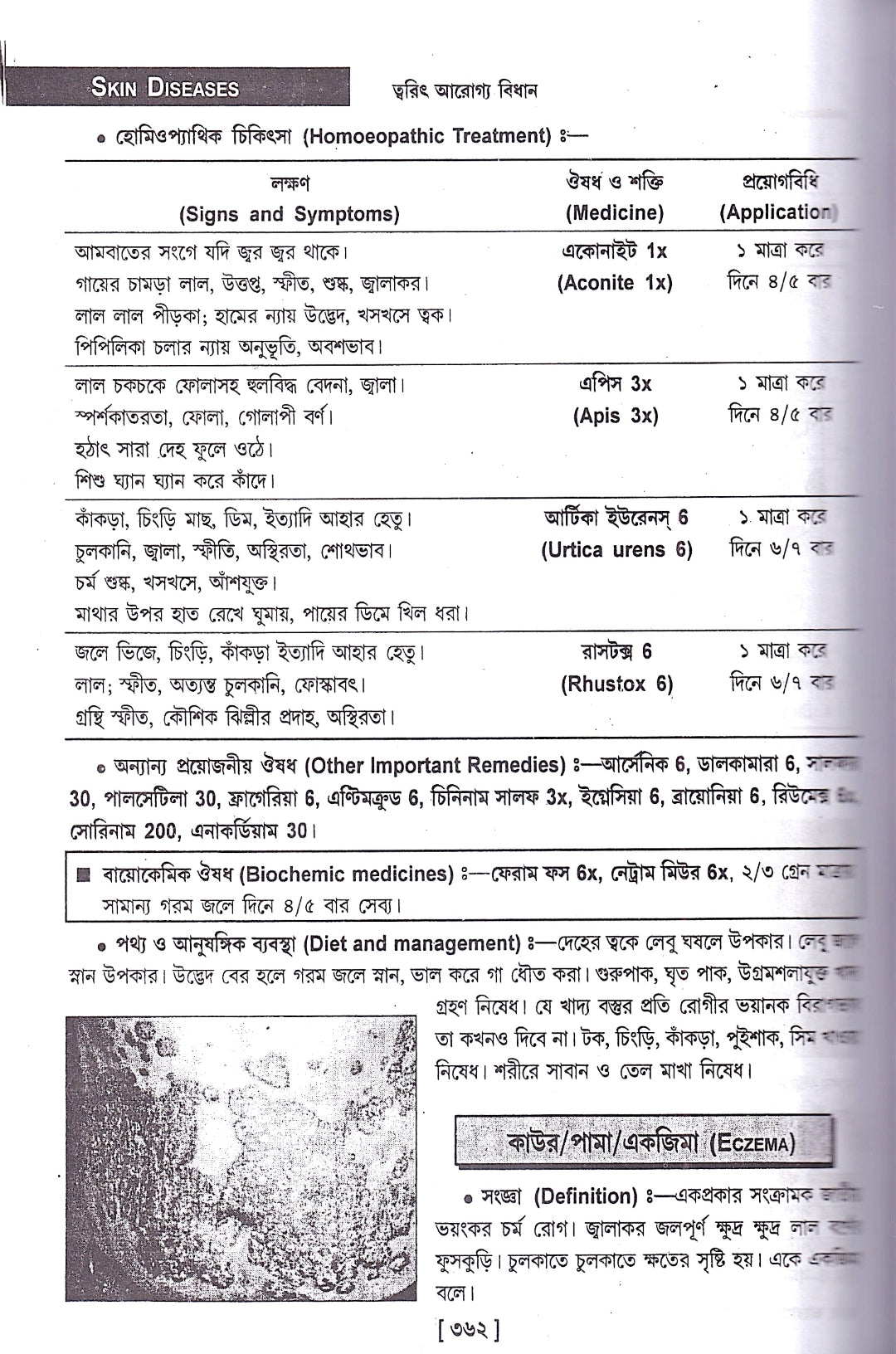 ত্বরিৎ আরোগ্য বিধান