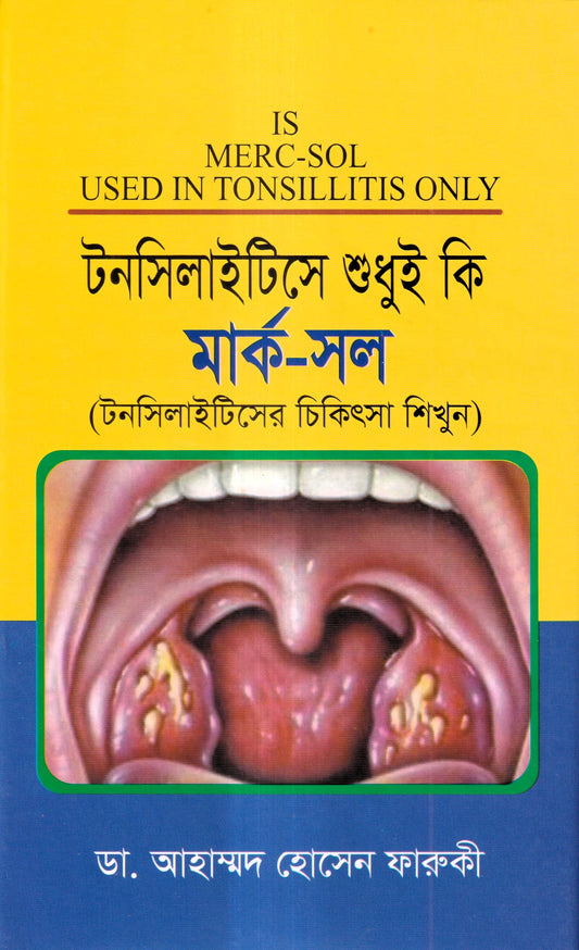 টনসিলাইটিসে শুধুই কি মার্ক-সল (টনসিলাইটিসের চিকিৎসা শিখুন)