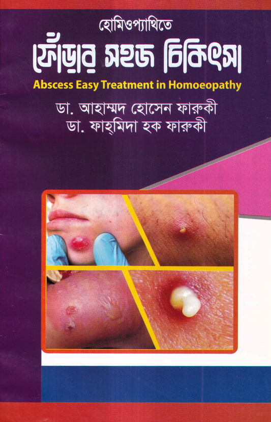 হোমিওপ্যাথিতে ফোঁড়ার সহজ চিকিৎসা