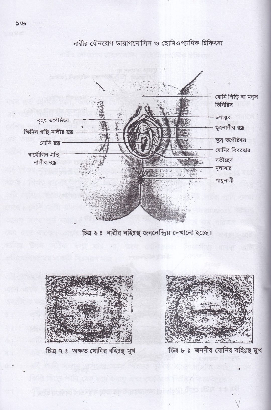 নারীর যৌনরোগ ডায়াগনোসিস ও হোমিওপ্যাথিক চিকিৎসা