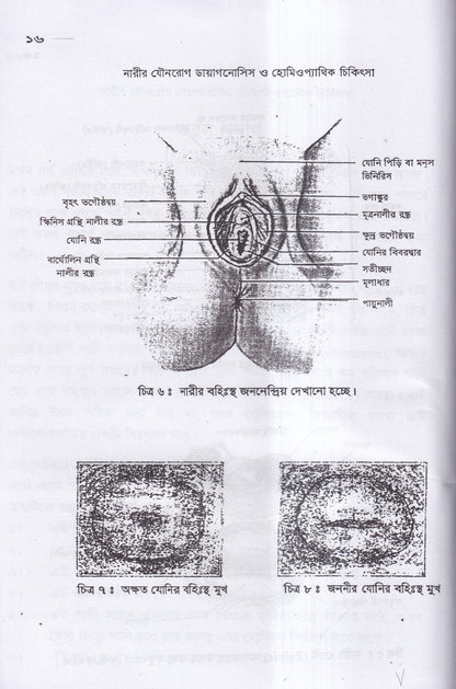 নারীর যৌনরোগ ডায়াগনোসিস ও হোমিওপ্যাথিক চিকিৎসা