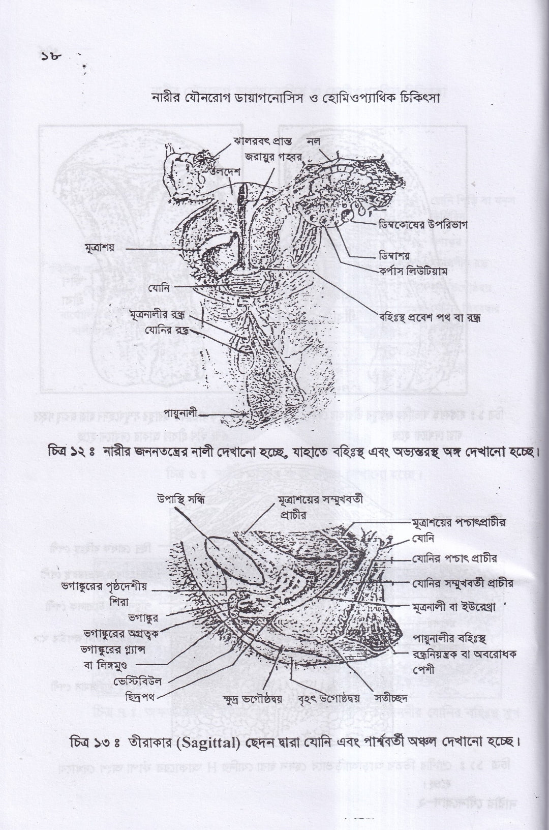 নারীর যৌনরোগ ডায়াগনোসিস ও হোমিওপ্যাথিক চিকিৎসা