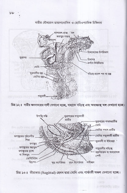 নারীর যৌনরোগ ডায়াগনোসিস ও হোমিওপ্যাথিক চিকিৎসা