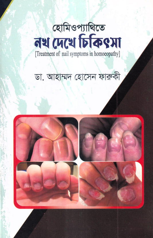 হোমিওপ্যাথিতে নখ দেখে চিকিৎসা