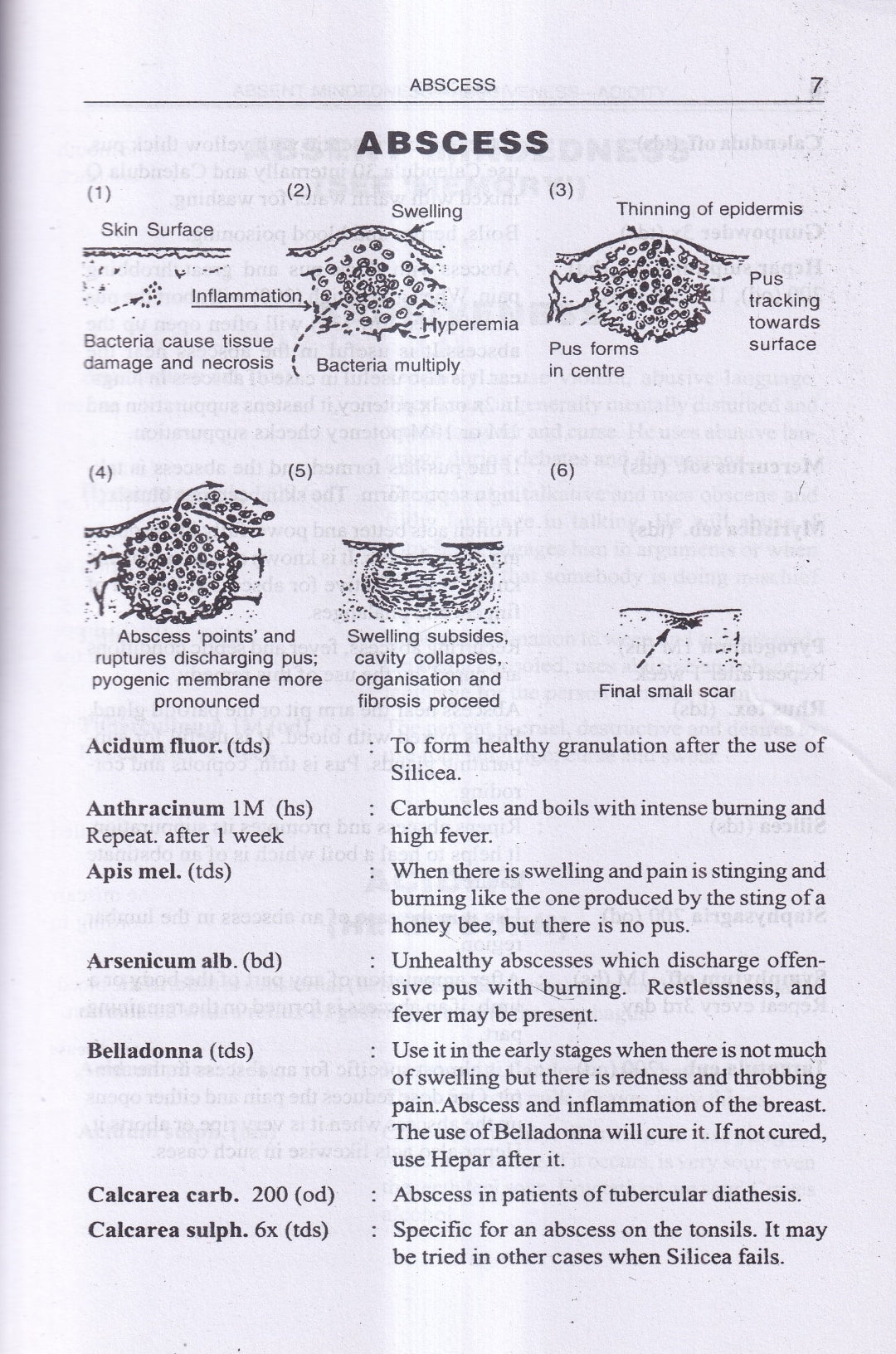 FIND YOUR REMEDY AN ILLUSTRATED HOMEOPATHIC GUIDE