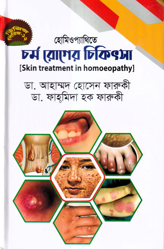 হোমিওপ্যাথিতে চর্মরোগের চিকিৎসা