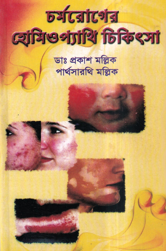 চর্মরোগের হোমিওপ্যাথি চিকিৎসা