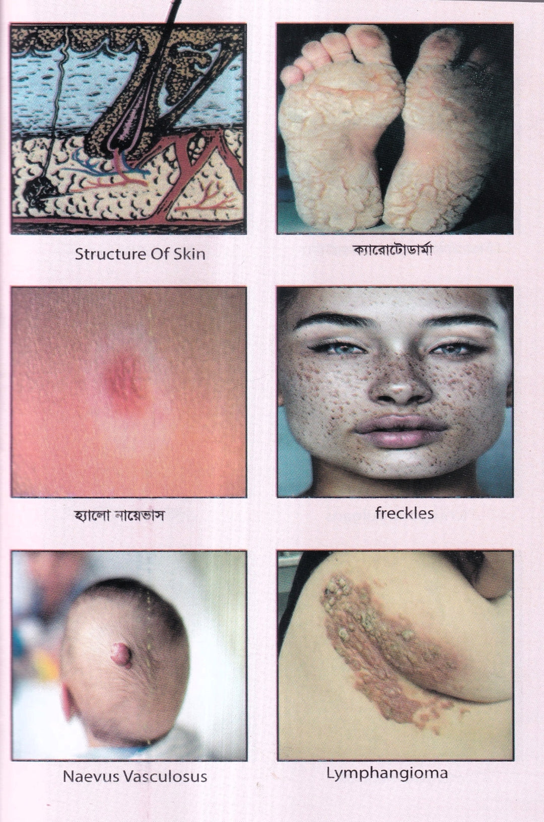 চর্মরোগের হোমিওপ্যাথি চিকিৎসা