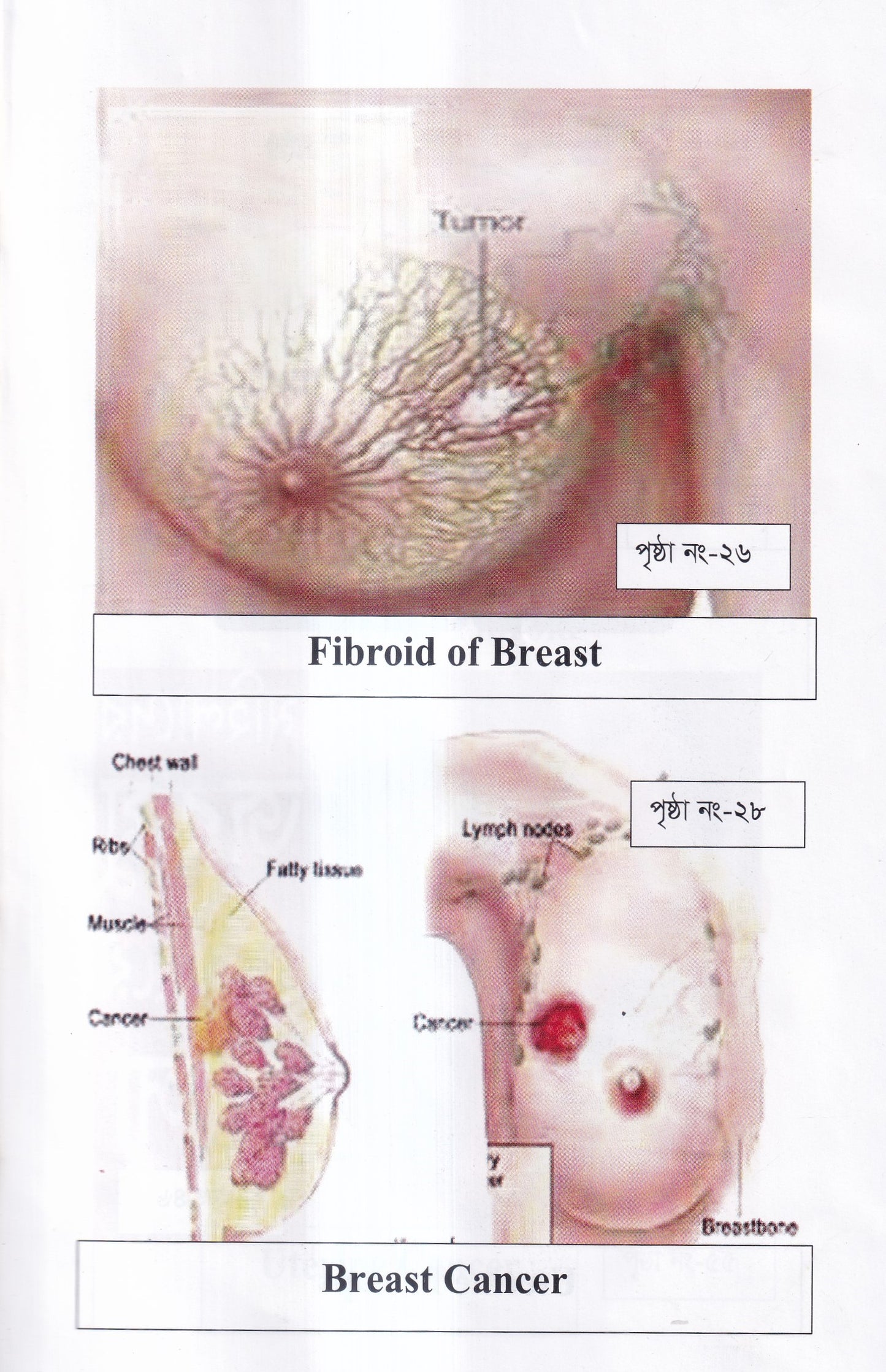দ্যা হ্যান্ড বুক অফ গাইনী ডিজিজ (The Hand Book of Gynae Disease)