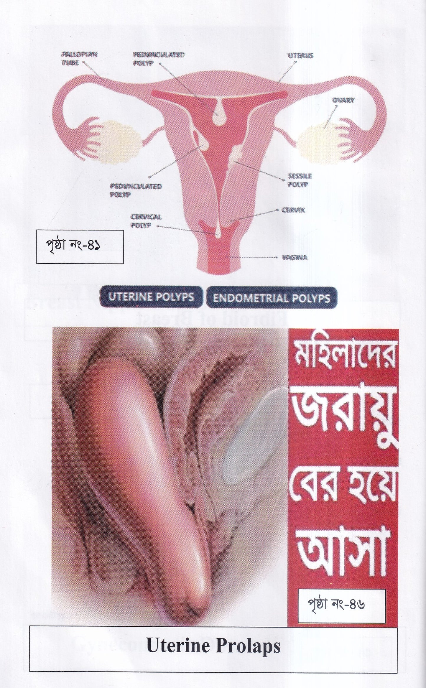 দ্যা হ্যান্ড বুক অফ গাইনী ডিজিজ (The Hand Book of Gynae Disease)