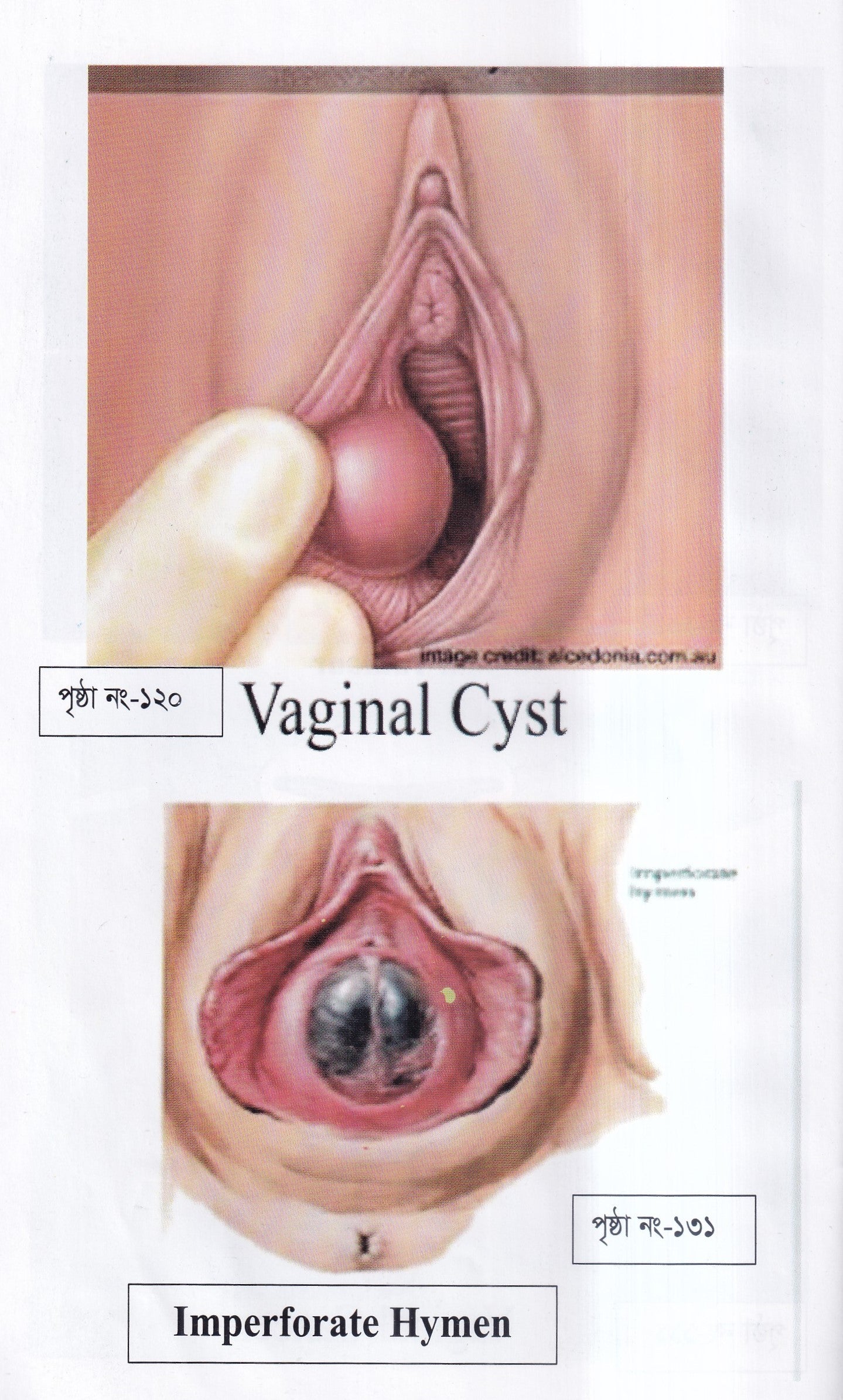 দ্যা হ্যান্ড বুক অফ গাইনী ডিজিজ (The Hand Book of Gynae Disease)