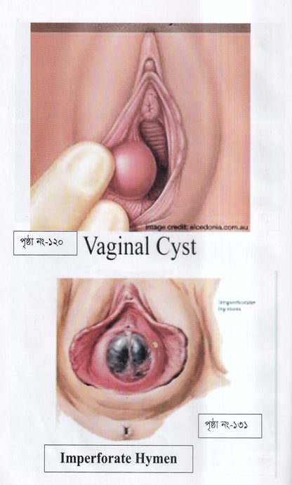 দ্যা হ্যান্ড বুক অফ গাইনী ডিজিজ (The Hand Book of Gynae Disease)