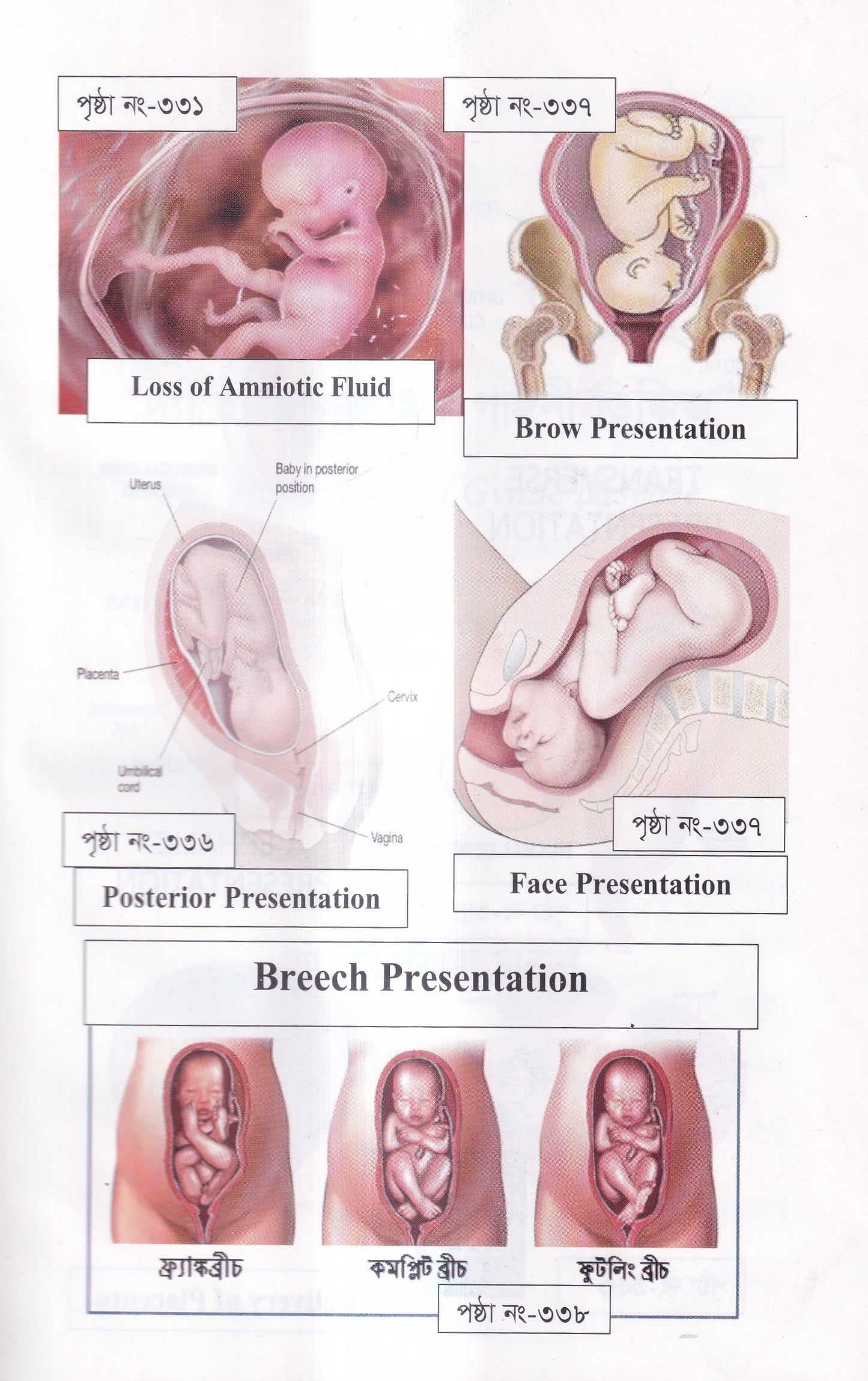 দ্যা হ্যান্ড বুক অফ গাইনী ডিজিজ (The Hand Book of Gynae Disease)