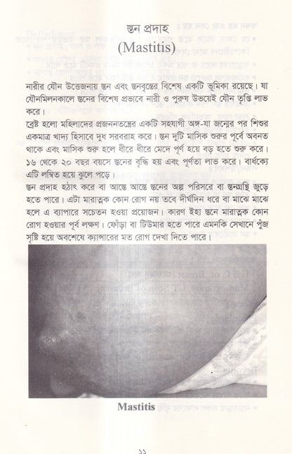 দ্যা হ্যান্ড বুক অফ গাইনী ডিজিজ (The Hand Book of Gynae Disease)