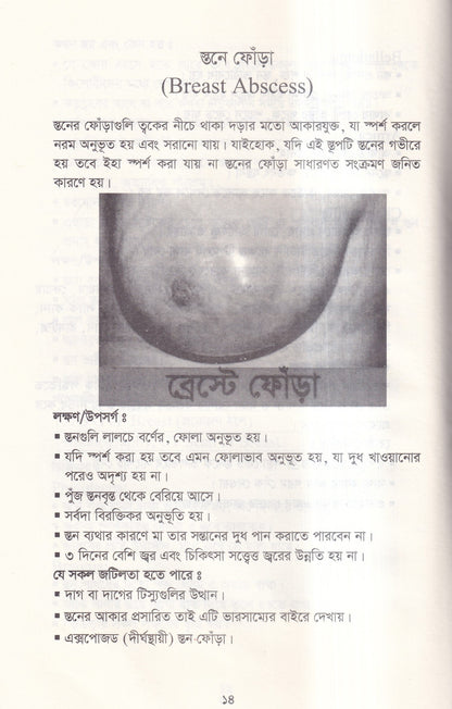 দ্যা হ্যান্ড বুক অফ গাইনী ডিজিজ (The Hand Book of Gynae Disease)