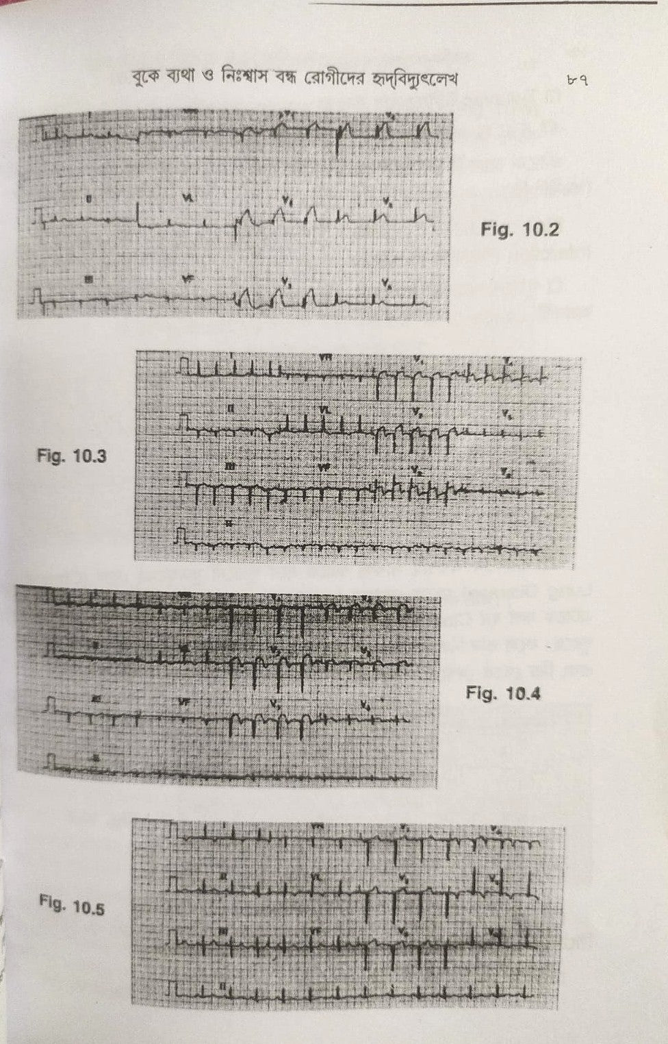 ই. সি. জি. ও এক্স-রে
