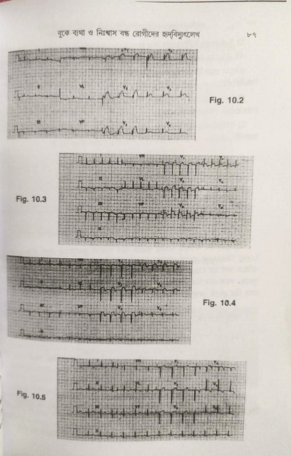 ই. সি. জি. ও এক্স-রে